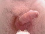 Dick