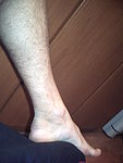 foot