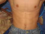 body