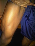 We're way beyond muscle tone here.