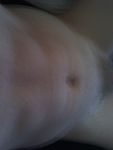 Abs